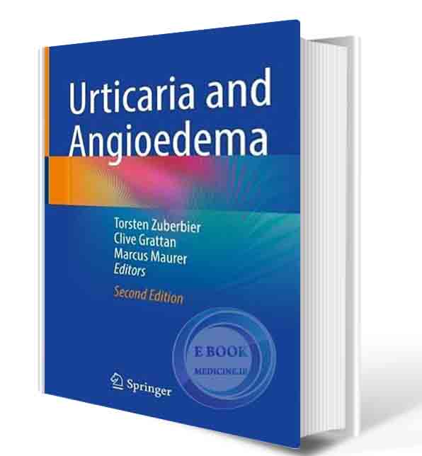 دانلود کتابUrticaria and Angioedema 2nd ed. 2021(ORIGINAL PDF)